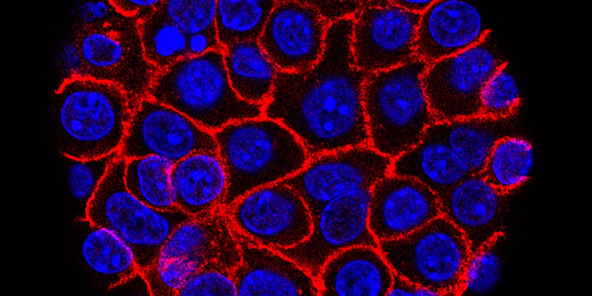 Experimental pill promises new hope for deadly pancreatic cancer